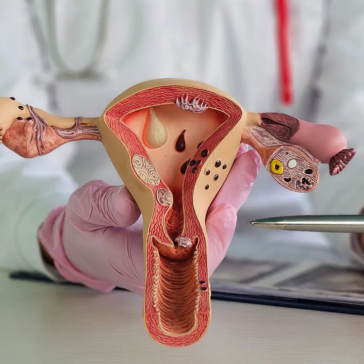 Closeup of female gynecologist holding anatomical model uterus and ovaries